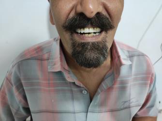 نمونه