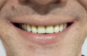 نمونه